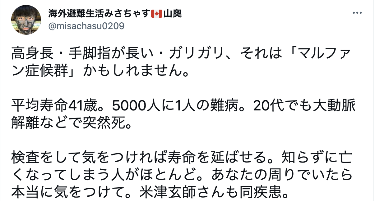 米津玄師の身長は1cmで確定 著名人と比較し検証してみたｗ 芸能 スポーツニュース